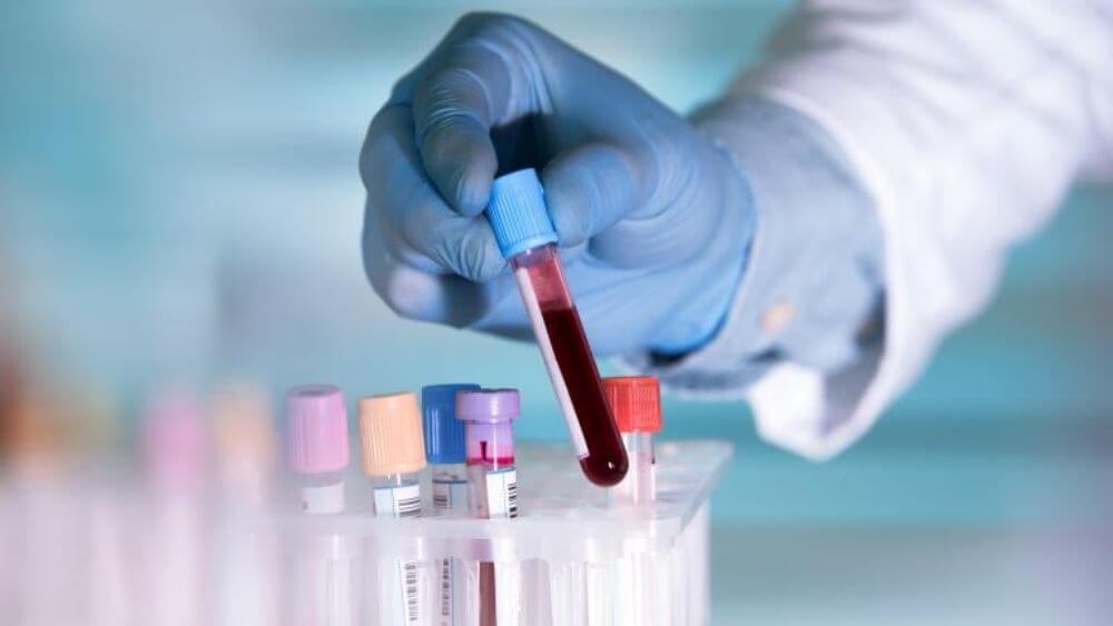 Científicos de UNIMAGDALENA aportan al estudio de variantes del COVID-19 que predominó en el tercer pico de la pandemia